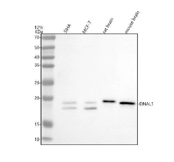 Western blot analysis of DNAL1 using anti-DNAL1 antibody (A12371-3)