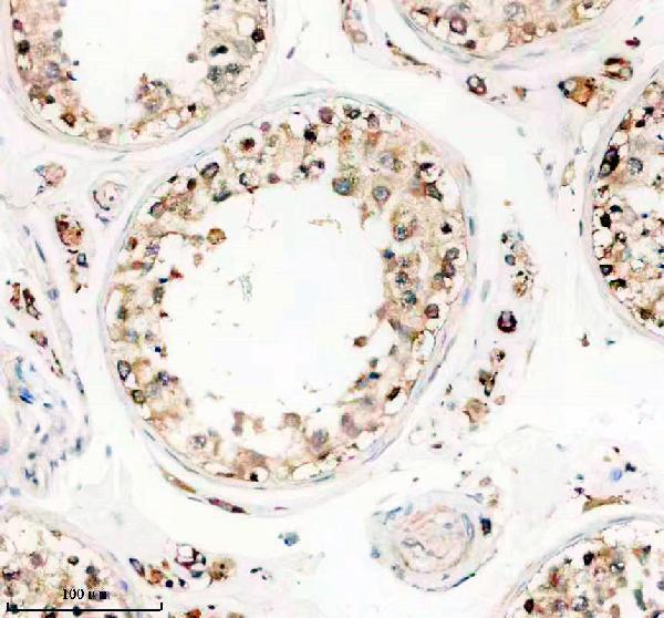 a12380 1 ttll1 primary antibodies ihc testing 1