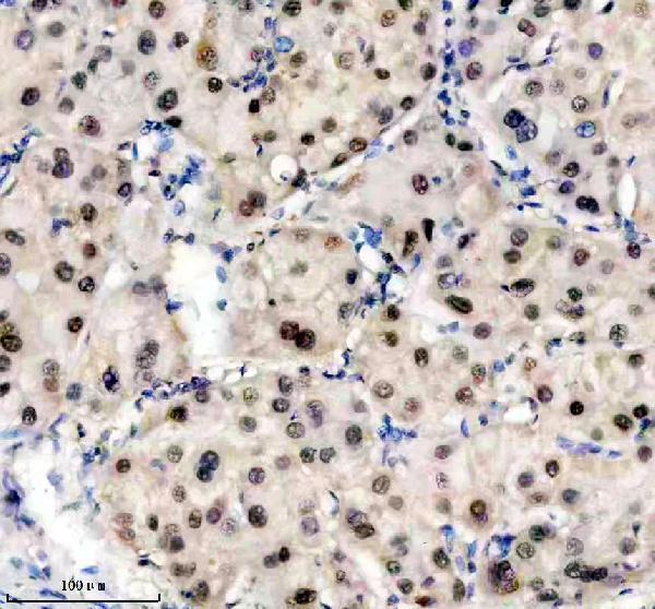 a12382 1 trim47 primary antibodies ihc testing 1