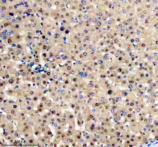 a12382 1 trim47 primary antibodies ihc testing 2