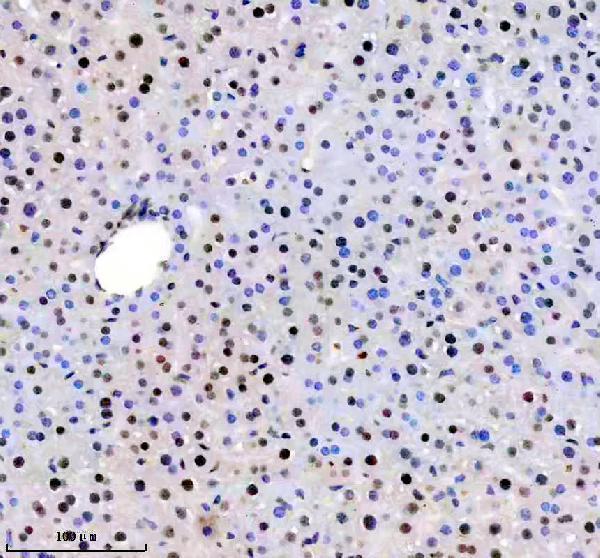 a12382 1 trim47 primary antibodies ihc testing 3