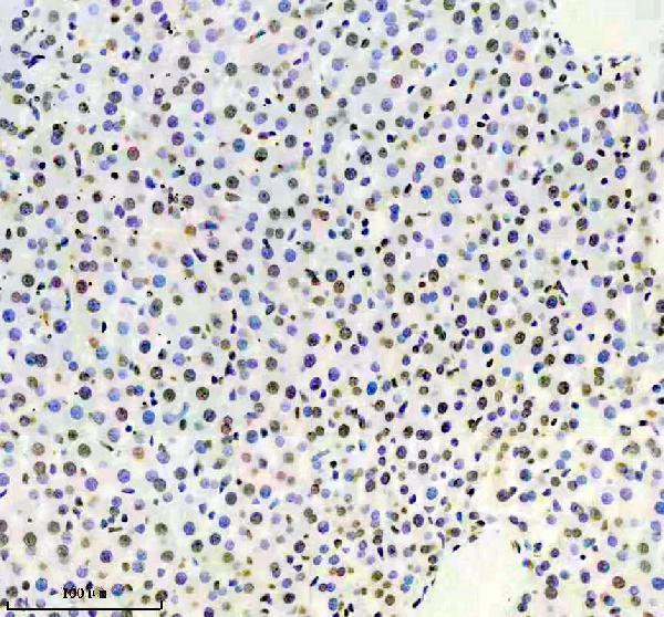 a12382 1 trim47 primary antibodies ihc testing 4