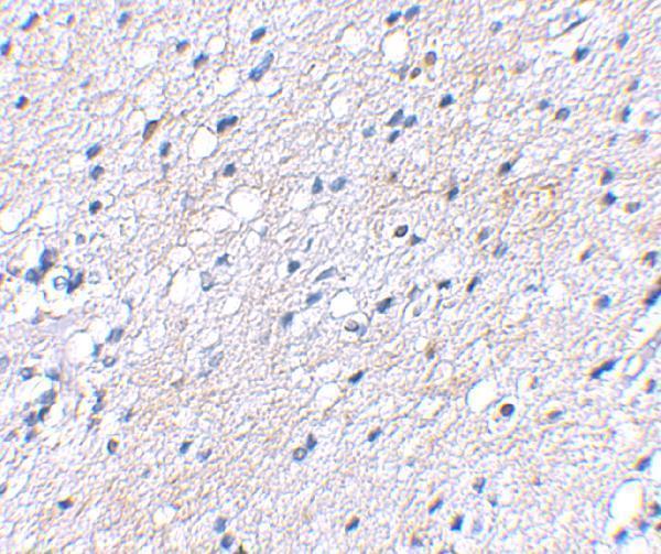 a12383 baiap3 primary antibodies ihc testing 2