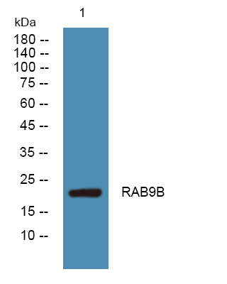 Western blot analysis of lysates from Jurkat cells, primary antibody was diluted at 1:1000, 4°over night