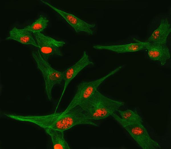 Figure 2. IF analysis of TSEN34 and Tubulin beta using anti-TSEN34 antibody (A12386-1) and anti-Tubulin beta antibody (M05613-4). TSEN34 and Tubulin beta was detected in an immunocytochemical section of U87 cells. Enzyme antigen retrieval was performed using IHC enzyme antigen retrieval reagent (AR0022) for 15 mins. The cells were blocked with 10% goat serum. And then incubated with 5 microg/mL rabbit anti-TSEN34 Antibody (A12386-1) and mouse anti-Tubulin beta Antibody (M05613-4) overnight at 4°C. Cy3 Conjugated Goat Anti-Rabbit IgG (BA1032) and DyLight®488 Conjugated Goat Anti-Mouse IgG (BA1126) were used as secondary antibody at 1:500 dilution and incubated for 30 minutes at 37°C. Visualize using a fluorescence microscope and filter sets appropriate for the label used. Figure 2. IF analysis of TSEN34 and Tubulin beta using anti-TSEN34 antibody (A12386-1) and anti-Tubulin beta antibody (M05613-4). TSEN34 and Tubulin beta was detected in an immunocytochemical section of U87 cells. Enzyme antigen retrieval was performed using IHC enzyme antigen retrieval reagent (AR0022) for 15 mins. The cells were blocked with 10% goat serum. And then incubated with 5 microg/mL rabbit anti-TSEN34 Antibody (A12386-1) and mouse anti-Tubulin beta Antibody (M05613-4) overnight at 4°C. Cy3 Conjugated Goat Anti-Rabbit IgG (BA1032) and DyLight®488 Conjugated Goat Anti-Mouse IgG (BA1126) were used as secondary antibody at 1:500 dilution and incubated for 30 minutes at 37°C. Visualize using a fluorescence microscope and filter sets appropriate for the label used.