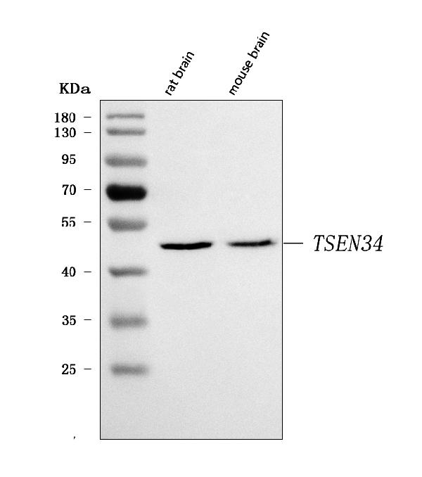 Figure 1. Western blot analysis of TSEN34 using anti-TSEN34 antibody (A12386-1). Electrophoresis was performed on a 5-20% SDS-PAGE gel at 70V (Stacking gel) / 90V (Resolving gel) for 2-3 hours. The sample well of each lane was loaded with 30 ug of sample under reducing conditions. Lane 1: rat brain tissue lysates, Lane 2: mouse brain tissue lysates. After electrophoresis, proteins were transferred to a nitrocellulose membrane at 150 mA for 50-90 minutes. Blocked the membrane with 5% non-fat milk/TBS for 1.5 hour at RT. The membrane was incubated with rabbit anti-TSEN34 antigen affinity purified polyclonal antibody (Catalog # A12386-1) at 0.5 microg/mL overnight at 4°C, then washed with TBS-0.1%Tween 3 times with 5 minutes each and probed with a goat anti-rabbit IgG-HRP secondary antibody at a dilution of 1:5000 for 1.5 hour at RT. The signal is developed using an Enhanced Chemiluminescent detection (ECL) kit (Catalog # EK1002) with Tanon 5200 system. A specific band was detected for TSEN34 at approximately 50 kDa. The expected band size for TSEN34 is at 34 kDa.