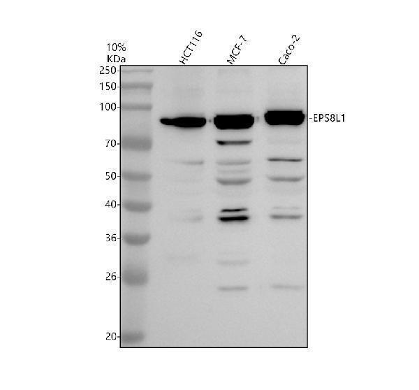 Western blot analysis of EPS8L1 using anti-EPS8L1 antibody (A12387-2)