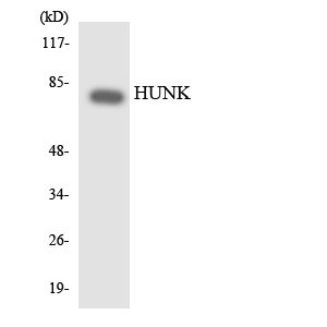 Western blot analysis of the lysates from 293 cells using HUNK antibody