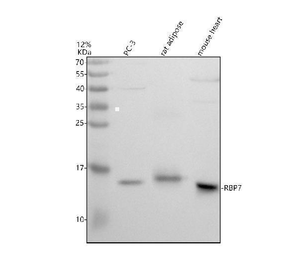Western blot analysis of RBP7 using anti-RBP7 antibody (A12402-1)
