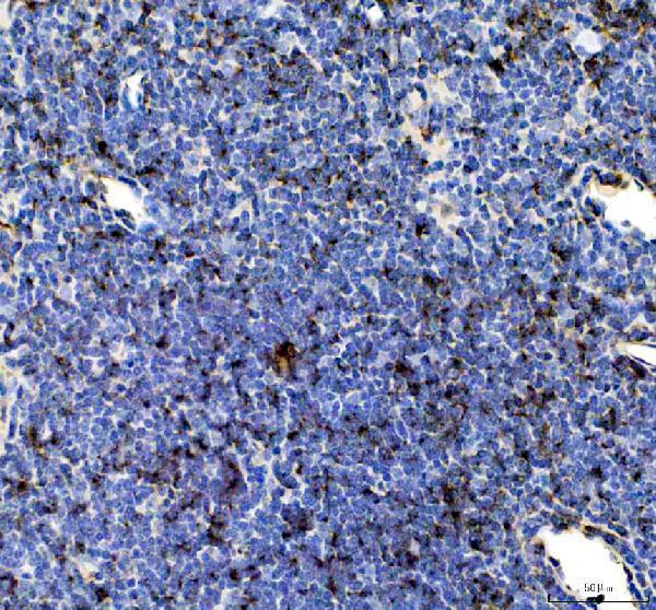 IHC analysis of GMFG using anti-GMFG antibody (A12403-1)