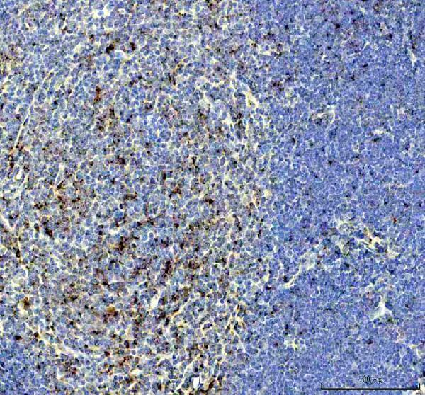 IHC analysis of GMFG using anti-GMFG antibody (A12403-1)