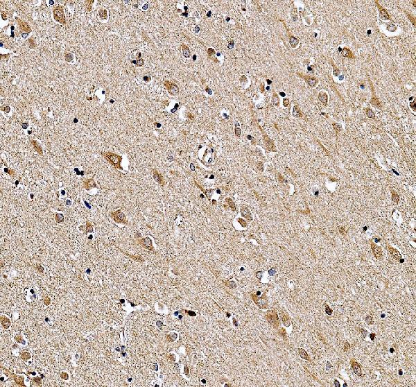 a12403 1 gmfg primary antibodies ihc testing 4