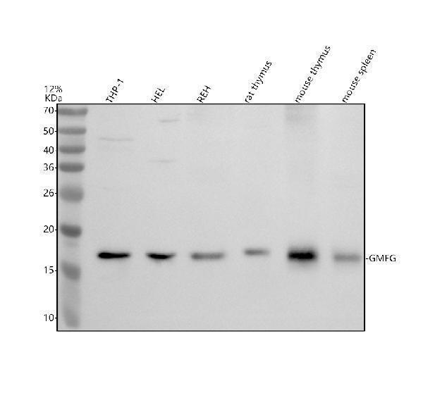 Western blot analysis of GMFG using anti-GMFG antibody (A12403-1)