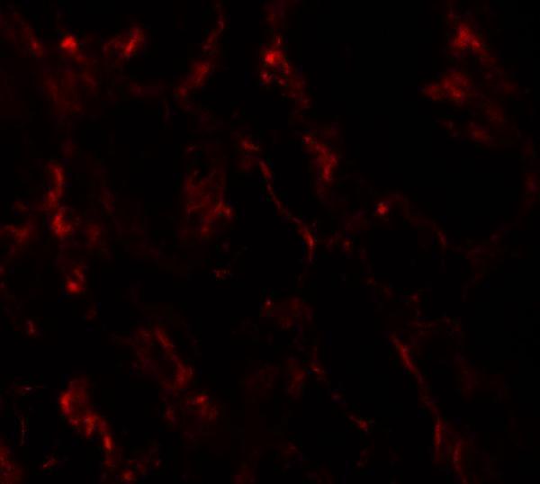 Immunofluorescence of GHDC1 in human breast tissue with GHDC1 antibody at 20 μg/mL