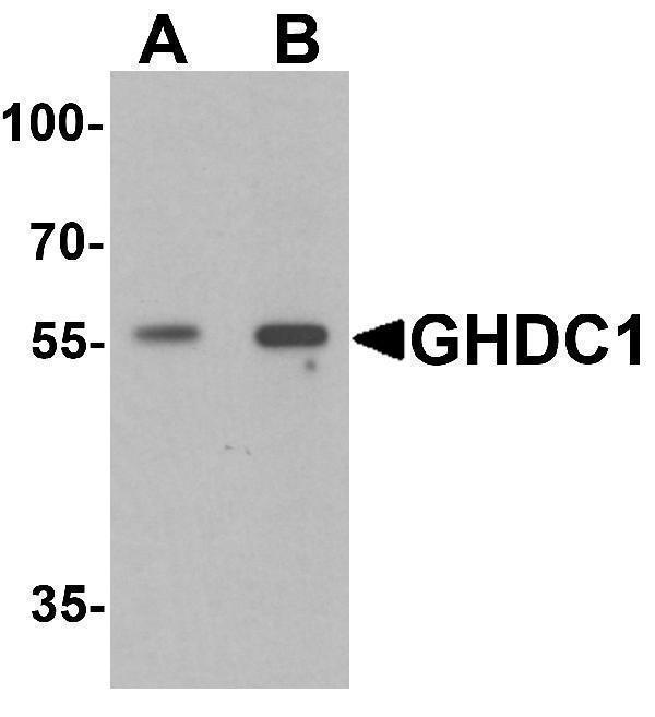 Western blot analysis of GHDC in 293 cell lysate with GHDC antibody at (A) 0