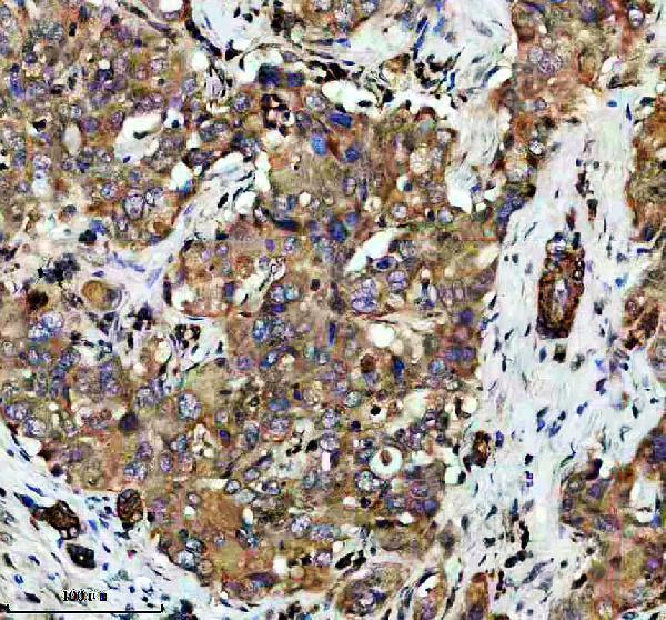 IHC analysis of FATE1 using anti-FATE1 antibody (A12412-1)