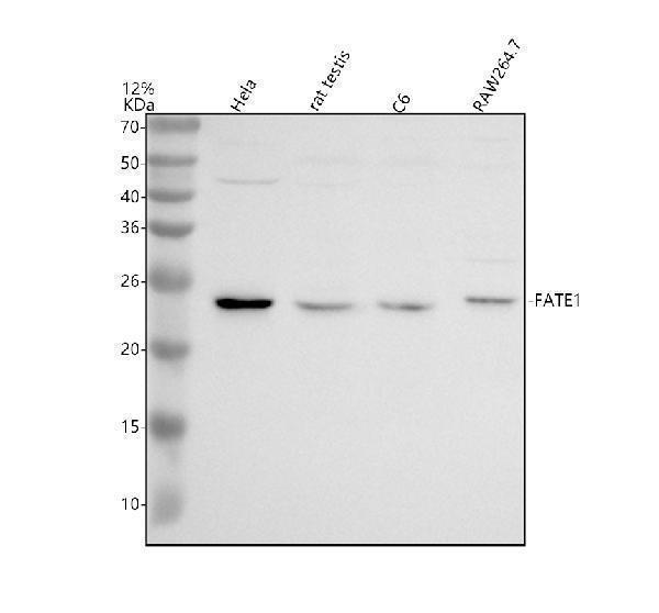 Western blot analysis of FATE1 using anti-FATE1 antibody (A12412-1)
