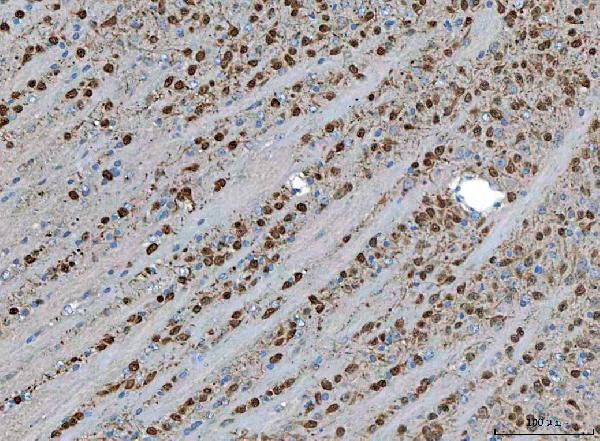 Figure 2. IHC analysis of TSR2 using anti-TSR2 antibody (A12413-1). TSR2 was detected in a paraffin-embedded section of mouse brain tissue. Heat mediated antigen retrieval was performed in EDTA buffer (pH 8.0, epitope retrieval solution). The tissue section was blocked with 10% goat serum. The tissue section was then incubated with 2 microg/ml rabbit anti-TSR2 Antibody (A12413-1) overnight at 4°C. Peroxidase Conjugated Goat Anti-rabbit IgG was used as secondary antibody and incubated for 30 minutes at 37°C. The tissue section was developed using HRP Conjugated Rabbit IgG Super Vision Assay Kit (Catalog # SV0002) with DAB as the chromogen. Figure 2. IHC analysis of TSR2 using anti-TSR2 antibody (A12413-1). TSR2 was detected in a paraffin-embedded section of mouse brain tissue. Heat mediated antigen retrieval was performed in EDTA buffer (pH 8.0, epitope retrieval solution). The tissue section was blocked with 10% goat serum. The tissue section was then incubated with 2 microg/ml rabbit anti-TSR2 Antibody (A12413-1) overnight at 4°C. Peroxidase Conjugated Goat Anti-rabbit IgG was used as secondary antibody and incubated for 30 minutes at 37°C. The tissue section was developed using HRP Conjugated Rabbit IgG Super Vision Assay Kit (Catalog # SV0002) with DAB as the chromogen.