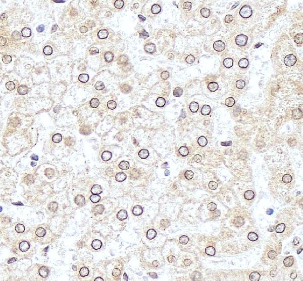 IHC analysis of TSR2 using anti-TSR2 antibody (A12413-1)