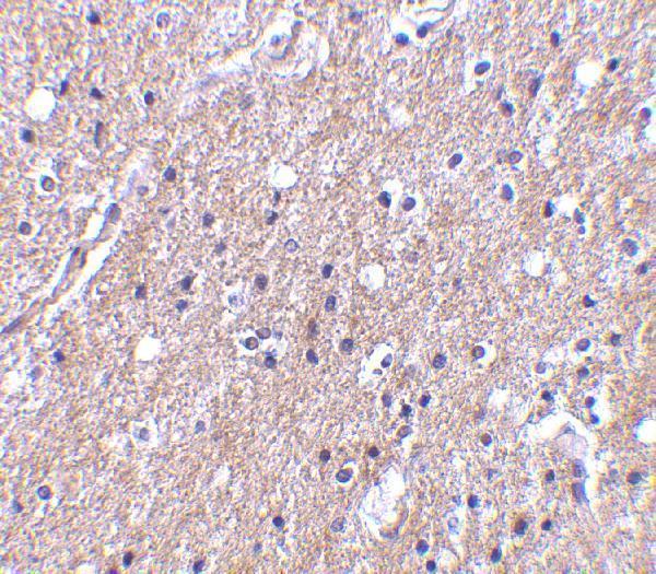 a12414 1 c1qtnf6 primary antibodies ihc testing 2