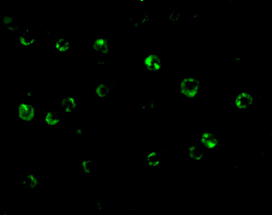 a12414 c1qtnf6 primary antibodies if testing 3