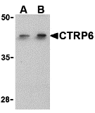 a12414 c1qtnf6 primary antibodies wb testing 1