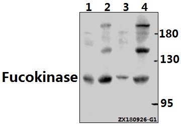 a12417 1 fuk primary antiboties wb testing 1
