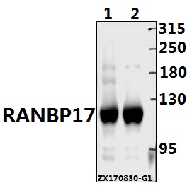 Western blot (WB) analysis of RANBP17 pAb at 1:500 dilution
Lane1:The Testis  tissue lysate of Rat(40ug)
Lane2:The Testis tissue lysate of Mouse(40ug)