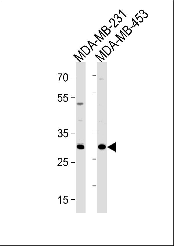 ASB11 Antibody (N-term) (Cat. # A12421) western blot analysis in MDA-MB-231,MDA-MB-453 cell line lysates (35ug/lane). This demonstrates the ASB11 antibody detected the ASB11 protein (arrow).