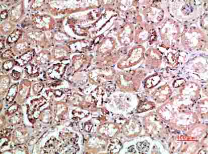 a12423 kir2dl5a primary antibodyes ihc testing 1