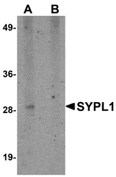 Western blot analysis of SYPL1 in human brain tissue lysate with SYPL1 antibody at 1 μg/mL in (A) the absence and (B) the presence of blocking peptide