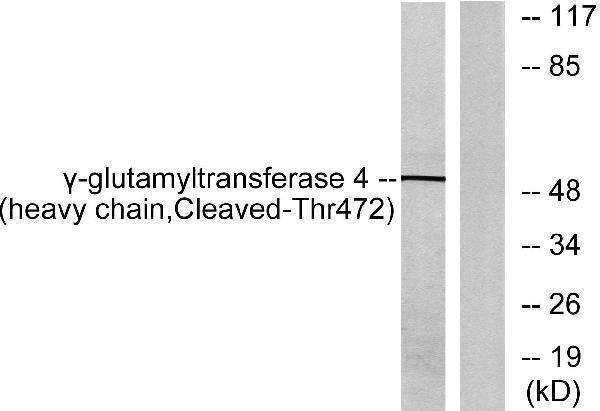 Western blot analysis of lysates from Jurkat cells, treated with etoposide 25uM 24h, using Gamma-glutamyltransferase 4 (heavy chain, Cleaved-Thr472) Antibody