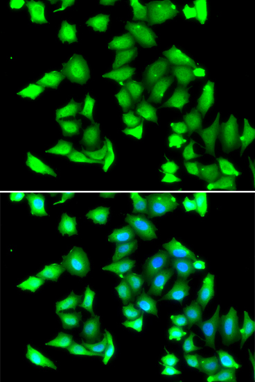 Immunofluorescence analysis of A549 cell using GSTCD antibody