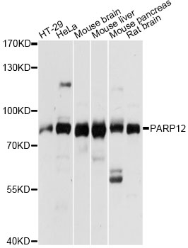 Western blot analysis of extracts of various cell lines, using PARP12 antibody at 1:3000 dilution