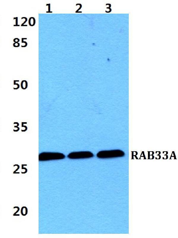 Western blot (WB) analysis of RAB33A polyclonal antibody at 1:500 dilution
Lane1:HEK293T cell lysate
Lane2:Raw264