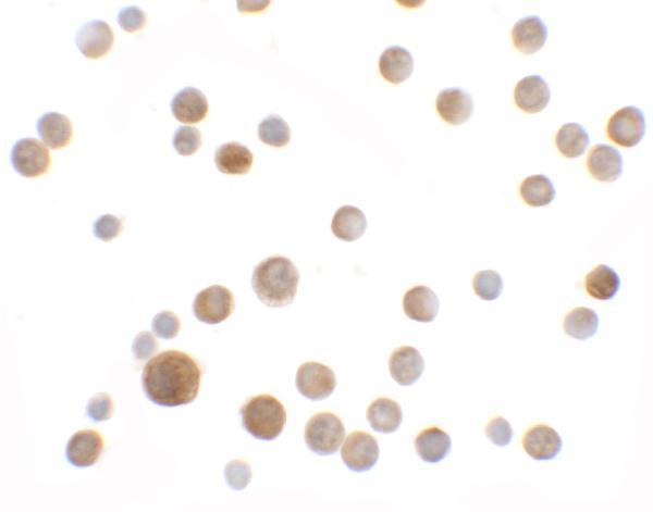 a12449 slc35d2 primary antibodies icc testing 2