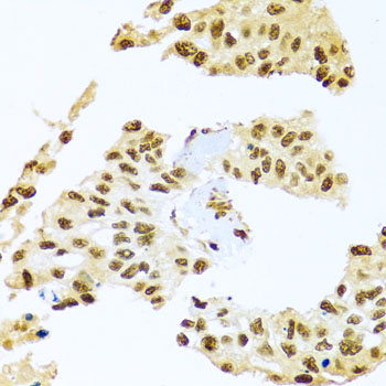 Immunohistochemistry of paraffin-embedded rat ovary using SMEK1 Rabbit pAb  at dilution of 1:100 
