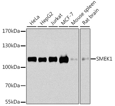 Western blot analysis of extracts of various cell lines, using SMEK1 antibody  at 1:1000 dilution