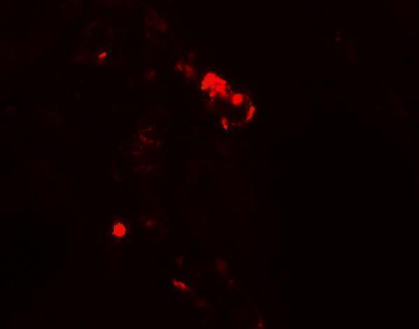 a12453 kiaa0226 primary antibodies if testing 3