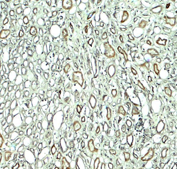 a12453 kiaa0226 primary antibodies ihc testing 2