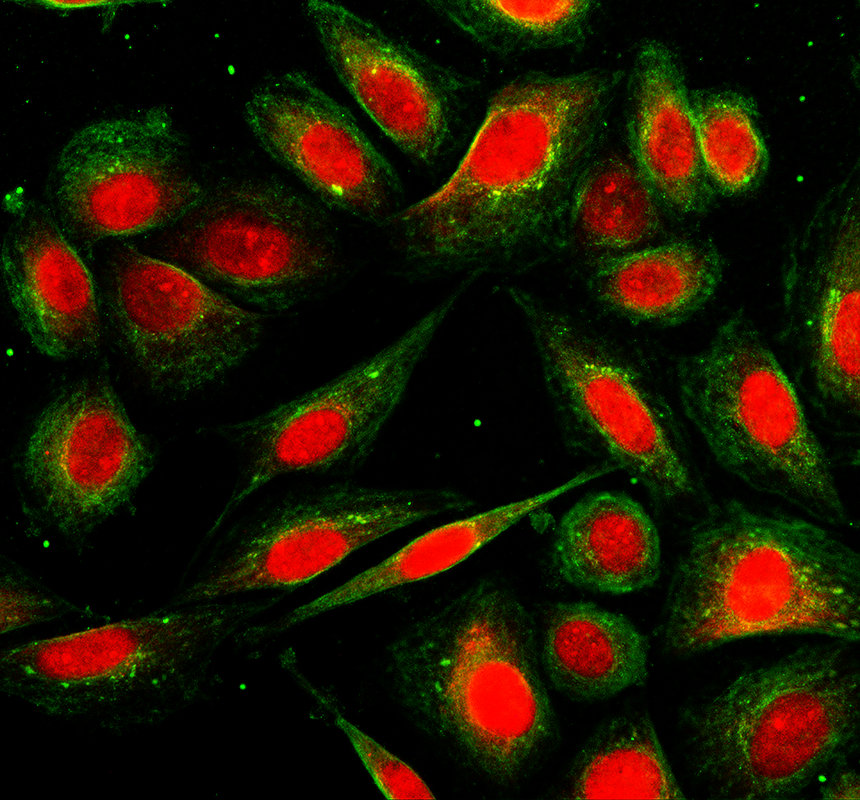 IF analysis of MED10 using anti-MED10 antibody (A12460-1) and anti-Alpha Tubulin antibody (M03989-3)