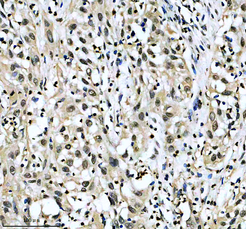 IHC analysis of MED10 using anti-MED10 antibody (A12460-1)