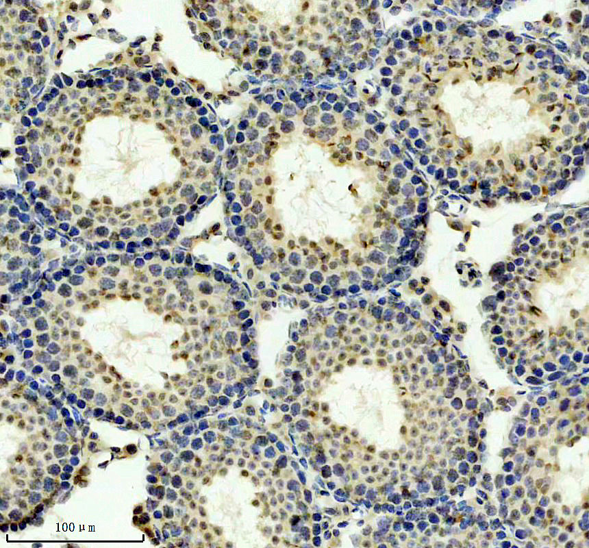 IHC analysis of MED10 using anti-MED10 antibody (A12460-1)