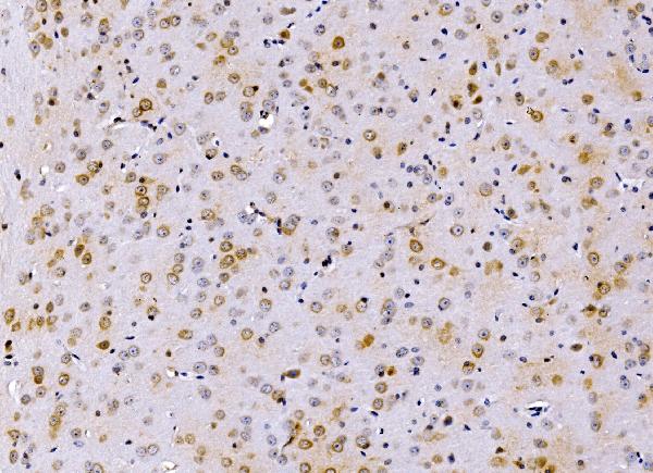 Figure 2. IHC analysis of PSMD8 using anti-PSMD8 antibody (A12465-1). PSMD8 was detected in a paraffin-embedded section of mouse brain tissue. Heat mediated antigen retrieval was performed in EDTA buffer (pH 8.0, epitope retrieval solution). The tissue section was blocked with 10% goat serum. The tissue section was then incubated with 2 microg/ml rabbit anti-PSMD8 Antibody (A12465-1) overnight at 4°C. Biotinylated goat anti-rabbit IgG was used as secondary antibody and incubated for 30 minutes at 37°C. The tissue section was developed using Strepavidin-Biotin-Complex (SABC) (Catalog # SA1022) with DAB as the chromogen.