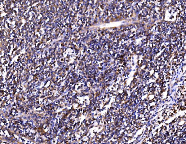 Figure 7. IHC analysis of PSMD8 using anti-PSMD8 antibody (A12465-1). PSMD8 was detected in a paraffin-embedded section of human tonsil tissue. Heat mediated antigen retrieval was performed in EDTA buffer (pH 8.0, epitope retrieval solution). The tissue section was blocked with 10% goat serum. The tissue section was then incubated with 2 microg/ml rabbit anti-PSMD8 Antibody (A12465-1) overnight at 4°C. Biotinylated goat anti-rabbit IgG was used as secondary antibody and incubated for 30 minutes at 37°C. The tissue section was developed using Strepavidin-Biotin-Complex (SABC) (Catalog # SA1022) with DAB as the chromogen.