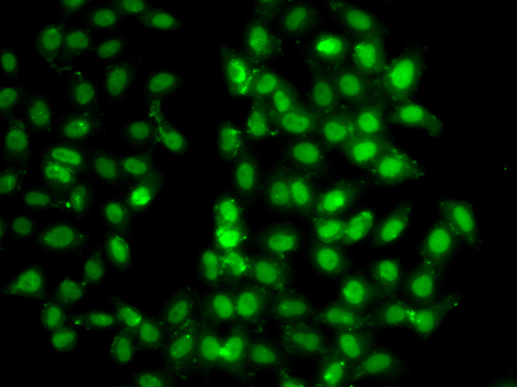 Immunofluorescence analysis of C6 cells using PSMD8 Rabbit pAb  at dilution of 1:100 