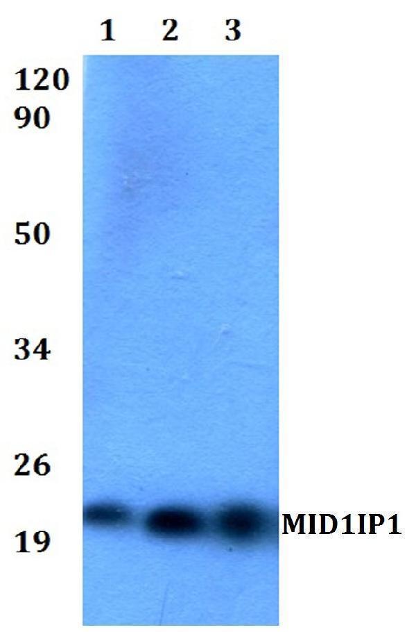 a12466 mid1ip1 primary antiboties wb testing 1
