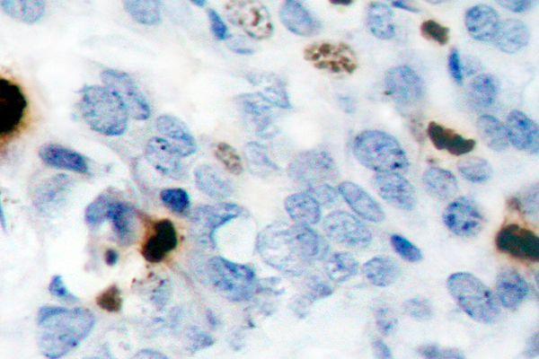 a12477s10 hist1h3a primary antiboties ihc testing 2