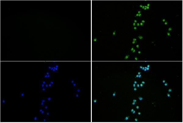 a12477t11 hist1h3a primary antiboties if testing 2