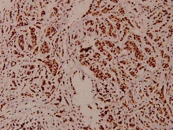 a12477t22 hist1h3a primary antiboties ihc testing 2